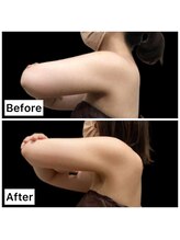 クールヴィラ(Cool Villa)/冷却3回痩身マッサージ6回