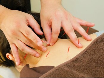 ユープラス(YOU PLUS)の写真/鍼灸師と柔道整復師の資格保持者による豊富な知識と高い技術力で不調に根本アプローチ！圧倒的楽な身体に♪