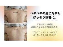ラプタス(Rapu+)