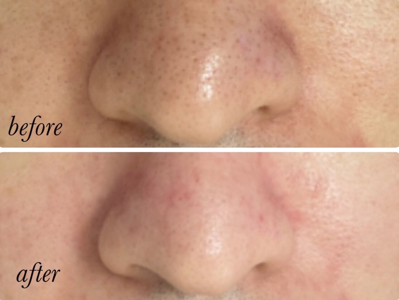 ララ(LaLa.)｜ホットペッパービューティー