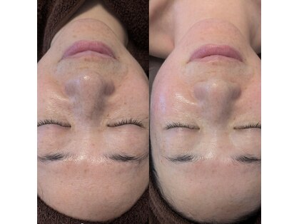 エステサロン エクラの写真