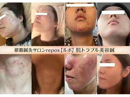 ルポ 那覇(repos)の写真