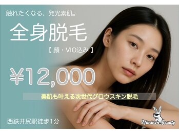 ミミロンビューティー(Mimiron Beauty)の写真/【夏に間に合う今がチャンス】初回限定 レディース☆全身脱毛 12,000円☆完全個室×最新マシン×効果実感