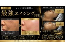 ミライ(Mirai)/深いしわやたるみ、リフトアップ