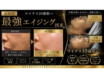 ミライ(Mirai)/深いしわやたるみ、リフトアップ