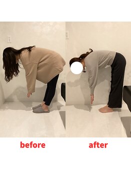 ナオル整体 福岡香椎院(NAORU整体)/30代女性施術事例【腰の痛み】