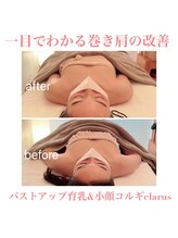 クラルス(clarus)/巻き肩改善