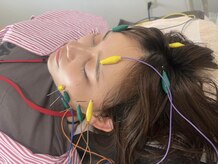 電気を流す美顔鍼