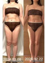 シエスタ リラクゼーションアンドデトックス(Siesta Relaxation&Detox)/2024・03・08→2025・05・19