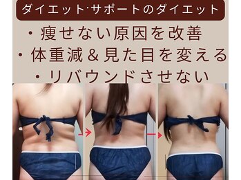 ダイエット サポート(DIET SUPPORT)/ダイエットサポートのダイエット