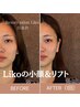 【3回分】お得に継続★最先端マシン3step『ハリ艶＆小顔』60分/59,400→