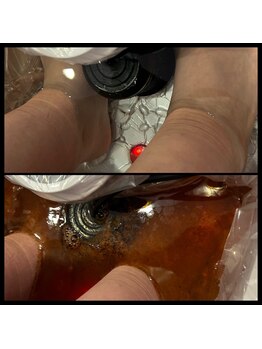 ホヌオラ(Honu Ola)/足湯感覚でデトックス