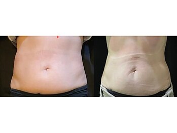 ザエステショップ/