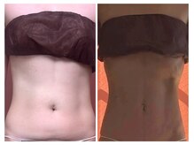 美容整体カラダリメイク(karada)/骨盤矯正ダイエットの結果