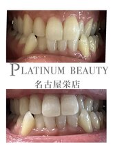 プラチナムビューティー 名古屋栄本店(PLATINUM BEAUTY)/お客様Before After