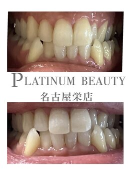 プラチナムビューティー 名古屋栄本店(PLATINUM BEAUTY)/お客様Before After