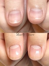 マリーロール 梅田店(Marie Laure)/自爪育成/深爪矯正/ネイルケア