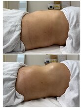 笑うヘソ歌う脳 銀座店/腸もみ初回と８回目の変化