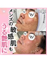 ホワイトワックス 名古屋金山店(WHITE WAX)/敏感肌もうる艶美肌に