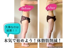 ヨサパーク 鹿島田店(YOSA PARK)の雰囲気（代謝UP・痩身.・美肌！キレイが叶う◎脱リバウンド！）
