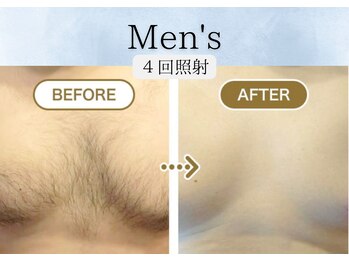 リベル(rebelle)/胸毛脱毛