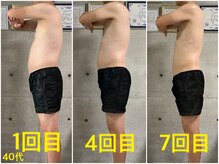 ペリー(PELLY)/男性40代　before after