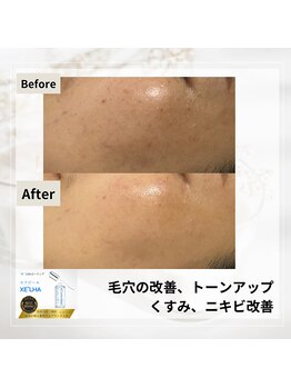 ルアナ(Luana)/セラピールの効果★