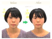 かとう整骨院/ビフォーアフター（整顔）