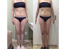 ルシアル 新宿代々木店(LUCIAL)/痩身オーダーメイド