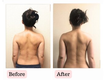 エナボン 上野(ENABON)/3か月.短期集中で背中スリミング