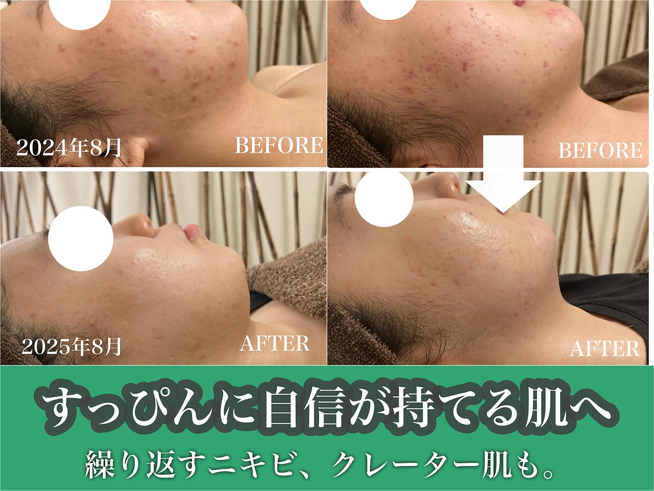 ヴィヴフォー(VIV for)｜ホットペッパービューティー