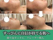 ヴィヴフォー(VIV for)
