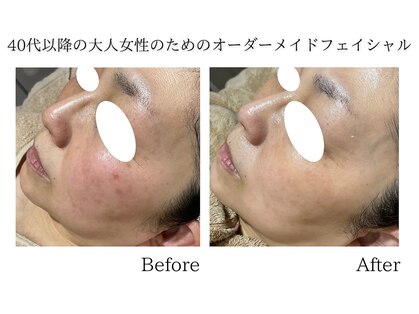 ラニエ(LANIE)の写真