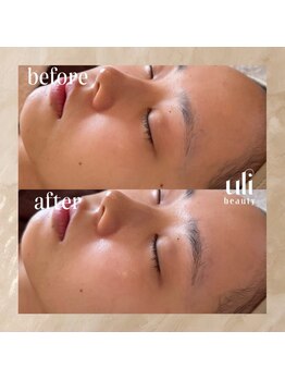 ウリ(uli beauty)/比較写真