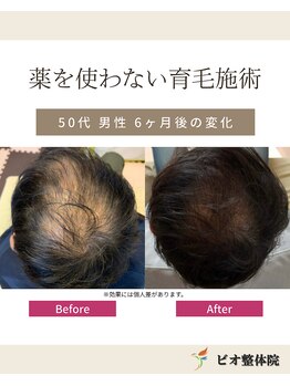コレア整体院(COREA整体院)/ 再生育毛促進術