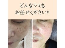 パルサロン(palsalon.)の雰囲気（再発リスクが激減されたpalsalon.シミケア）