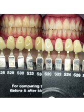 トウキョウスワーズ 池袋店(TOKYO SWRS)/#ホワイトニング #池袋 #渋谷