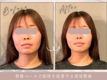 ほぐし屋 かすがい/小顔リフト矯正＋美姿勢整体