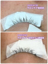ボーグル ビューティー(BOGL BEAUTY)/サロン専用高濃度美容液ケア
