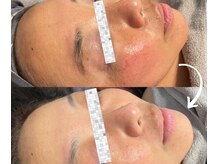 ナナイロヨジドン(nanairo麗姿堂)の雰囲気（サーモンDNA配合の゛リジュラン゛でハリ・弾力・くすみ改善☆）