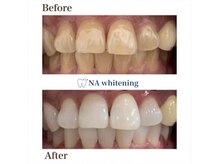 エヌエーホワイトニング たまプラーザ店(NAホワイトニング)の雰囲気（忙しい方でも通いやすいプランをご用意！セルフホワイトニング）