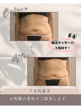 リンガ(Ringa)/ビフォーアフター【腸活ケア】