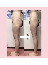 スワン 新栄店(SWAN)/卒業後もさらにサイズダウン★