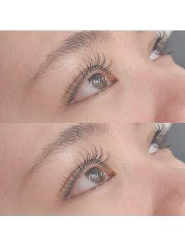 ロコ(Loco by neolive)/セーブル 100本