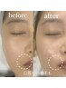 眉毛wax＋フェイスwax(パック付) 14,700→12,000
