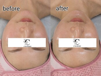 シャリル(charire)/うるツヤ水光肌