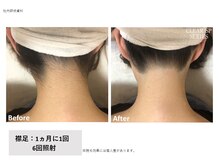 シズク ビューティーサロン(SHIZUKU beauty salon )/