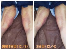 ラングル 福津(L’ongle)の雰囲気（美容外科後の、インディバによるダウンタイム施術も行ってます！）