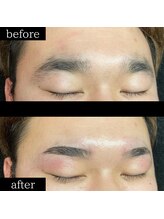 ユー 千葉駅前店(you)/症例写真