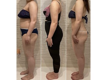 エキュレ ジャーニー トゥ マイ トータル ビューティー(equrer)/腸内環境を整えると！？